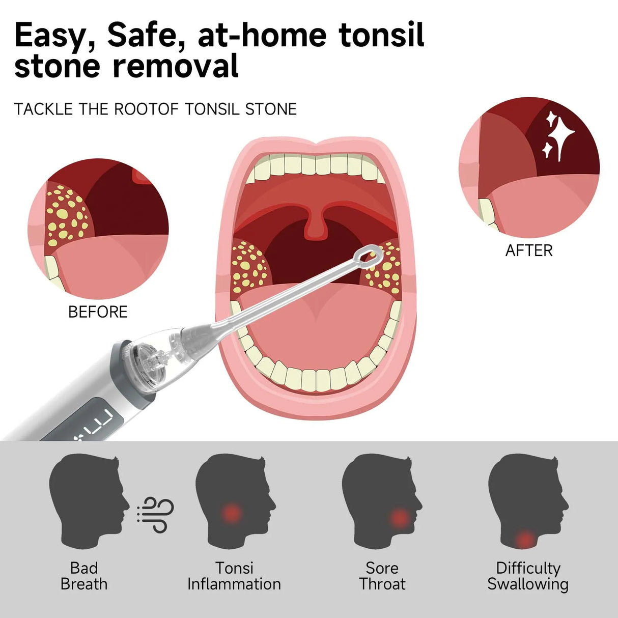 Vacuum Tonsil Stone Remover Tool Built-In LED light  8 Suction Modes Anti Bad Breath Oral Irrigator&Tongue Coating Scraper