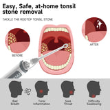 Vacuum Tonsil Stone Remover Tool Built-In LED light  8 Suction Modes Anti Bad Breath Oral Irrigator&Tongue Coating Scraper