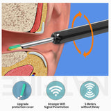 Smart Visual Ear Cleaner HD Ear Sticks Otoscope USB C Charging Endoscope Wax Removal Tool Earpick MIni Camera Health Care Set